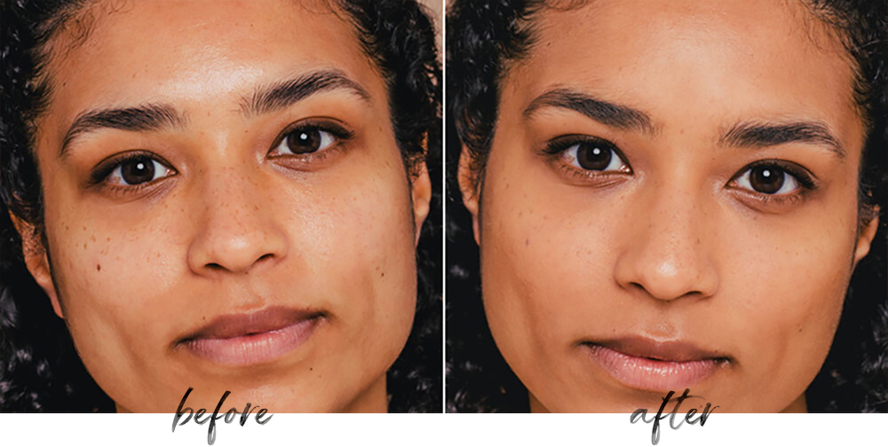 Foundation before & after